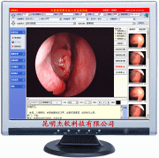 供应杰软耳鼻喉影像系统工作站